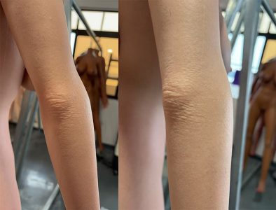 orangein-skin-texture orangein-skin-texture